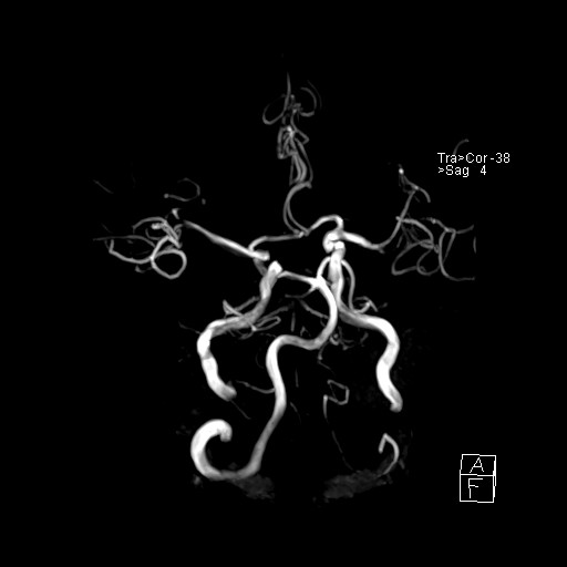 Click on the Serie image to view the images of VILLANUEVA, WILLIAM A.